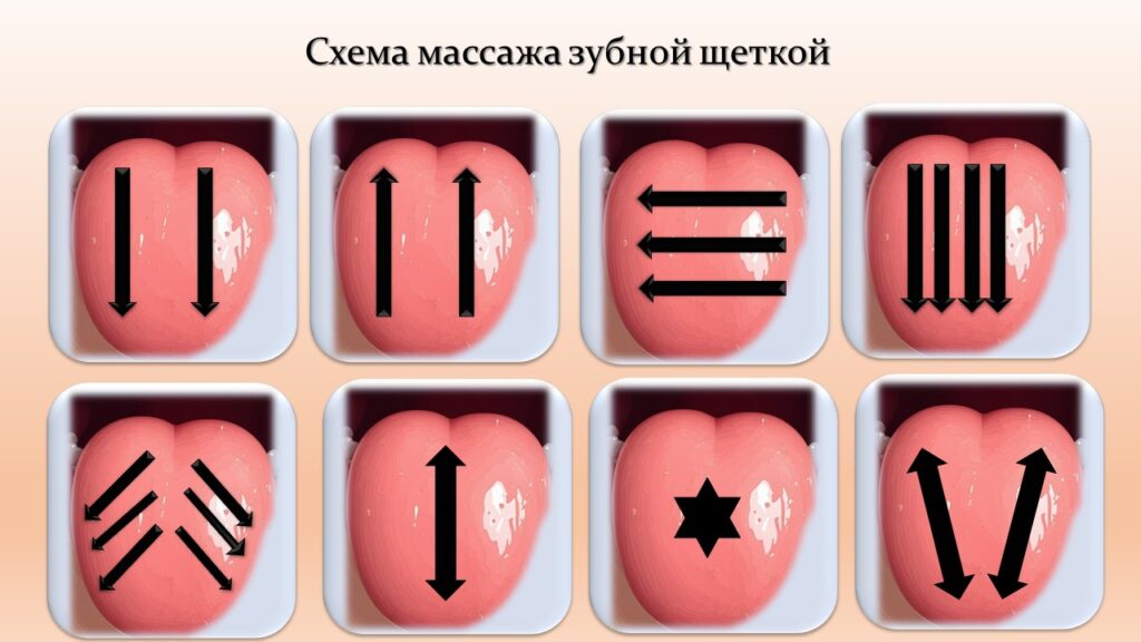 Логопедический массаж языка зубной щеткой в домашних условиях